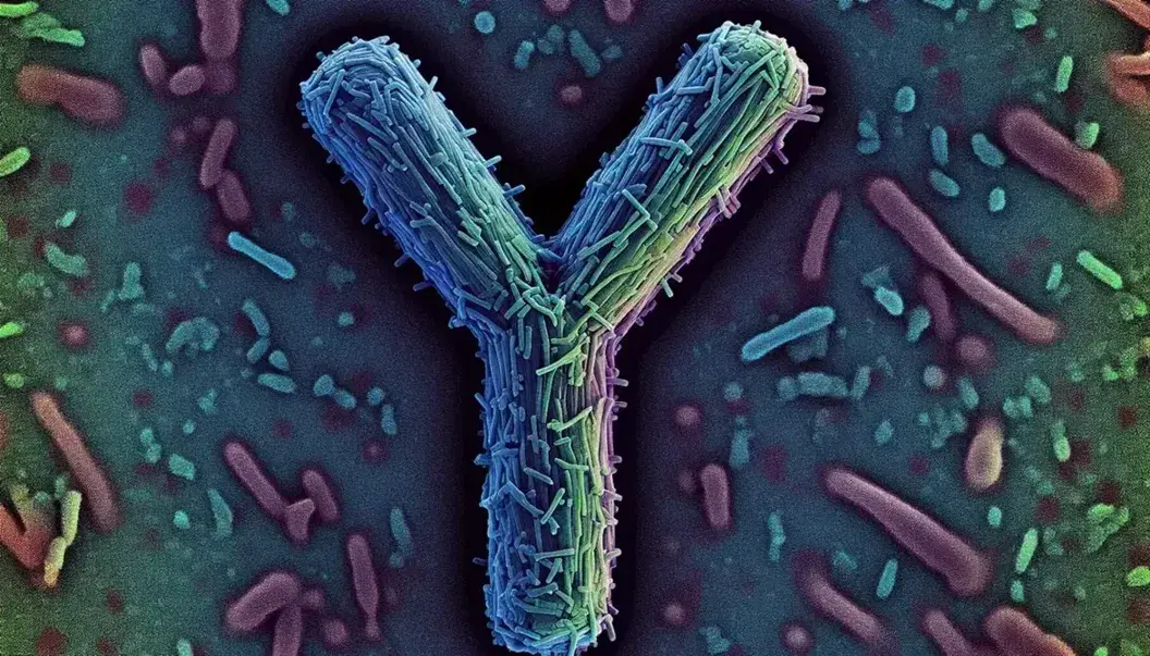 Micrografía electrónica a color mostrando múltiples estructuras en forma de 'Y' con brazos angulares y extremos ensanchados sobre fondo oscuro.