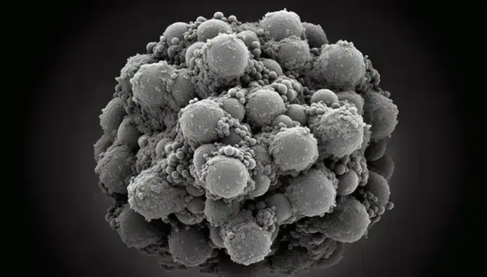Micrografía electrónica de transmisión mostrando partículas coloidales nanométricas agrupadas en estructuras irregulares, suspendidas en medio líquido.