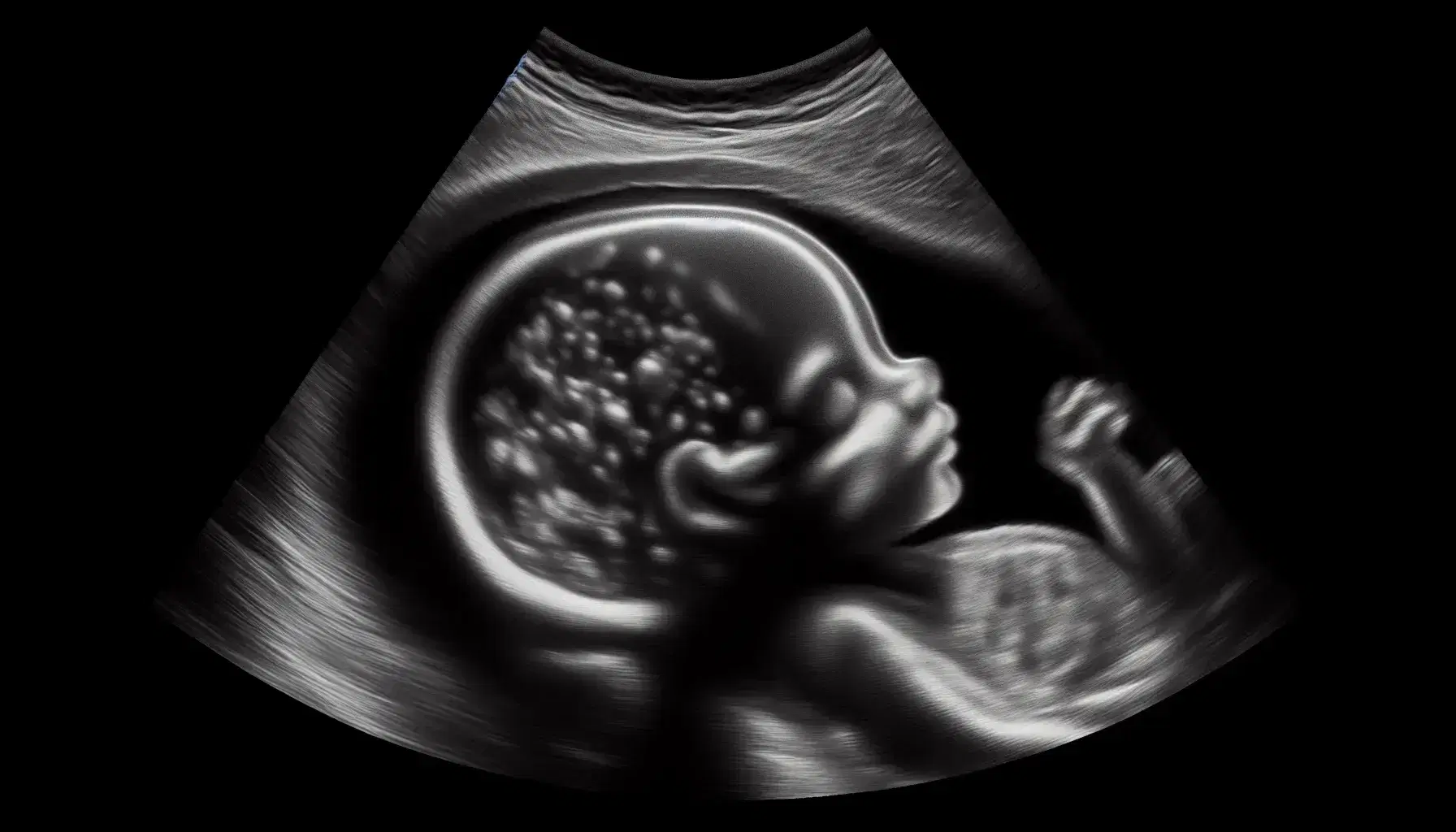 Ecografía en tiempo real mostrando perfil de feto humano en útero, con cabeza, torso y extremidades visibles, y cordón umbilical conectando al abdomen fetal.