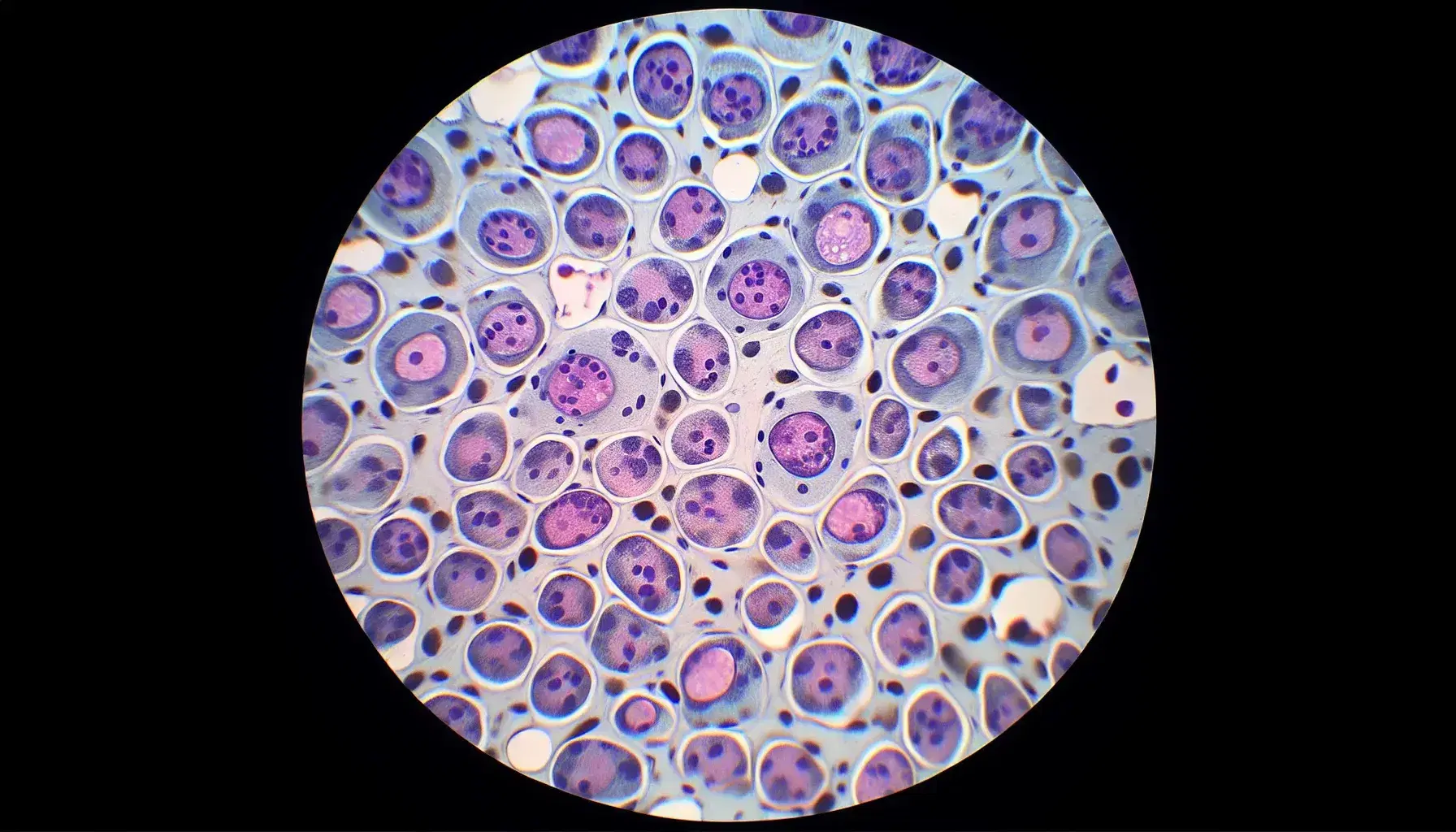 Vista microscópica de células humanas teñidas en tejido con núcleos púrpura y citoplasma claro, mostrando la estructura celular y el entorno extracelular.