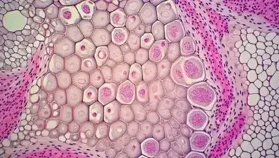 Vista microscópica de tejido epitelial humano con células poligonales y núcleos oscuros, sin espacios intercelulares, teñido en tonos rosas y morados.