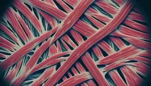 Vista microscópica de fibras musculares entrecruzadas con estructuras estriadas en tonos rojos y rosas, sin núcleos visibles, sobre fondo oscuro.