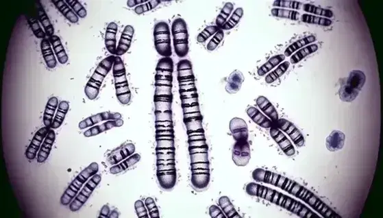 Close up of a karyotype with chromosomes sorted into pairs, distinct XX or XY sex chromosomes and purple banding pattern on a white background.