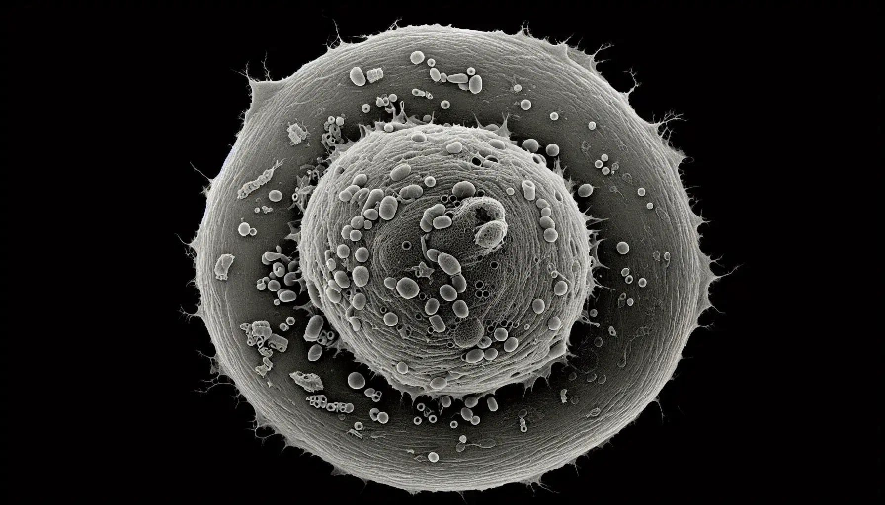 Cellula umana al microscopio elettronico con membrana plasmatica, nucleo e organelli interni visibili in diverse tonalità di grigio.